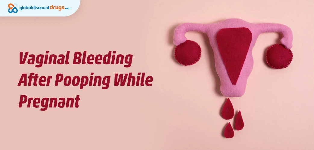 Vaginal Bleeding After Pooping While Pregnant