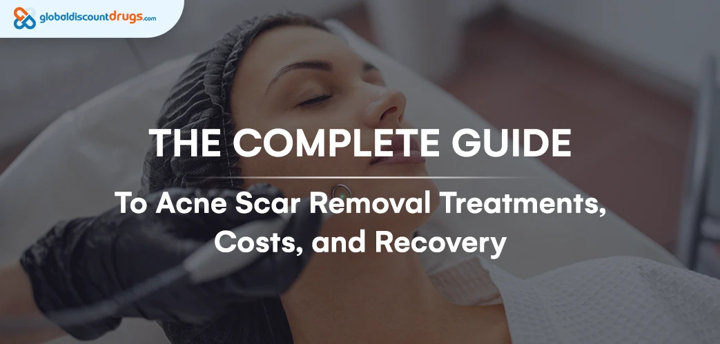 The Complete Guide to Acne Scar Removal