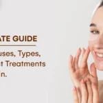 The Ultimate Guide to Acne