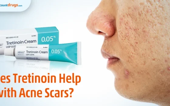 Does Tretinoin Help with Acne Scars