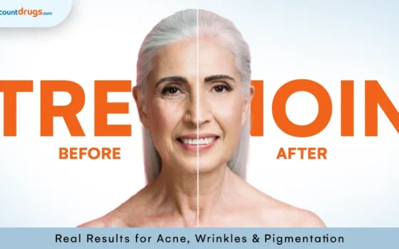 Tretinoin Before and After Real Results for Acne, Wrinkles & Pigmentation