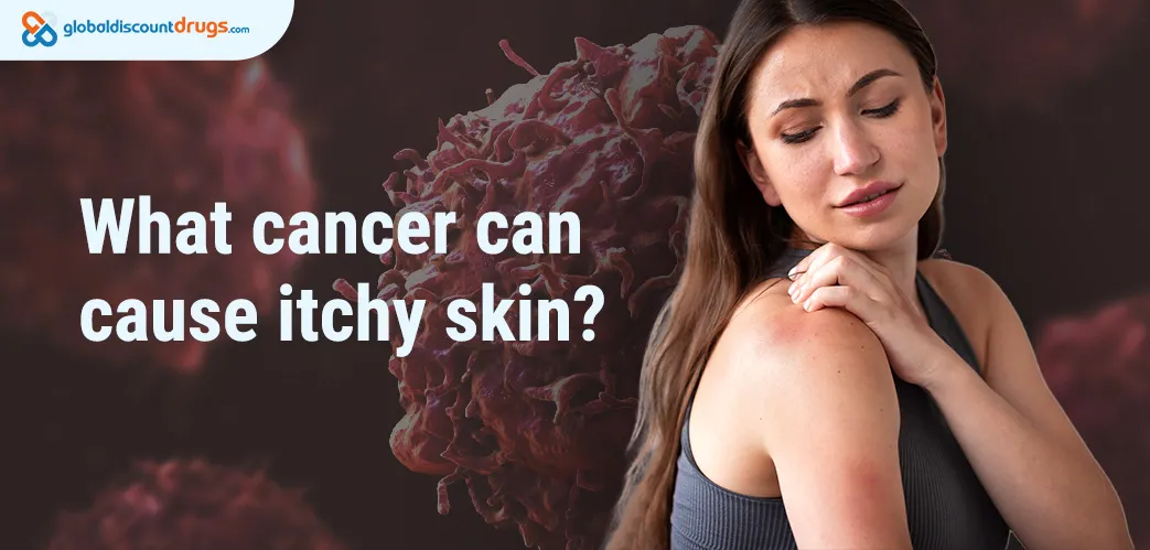 What cancer can cause itchy skin
