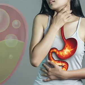 Acid Reducer-Acid Reflux