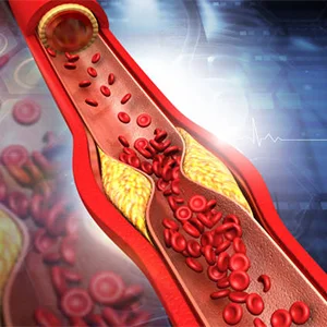 Anti Hyperlipidemics