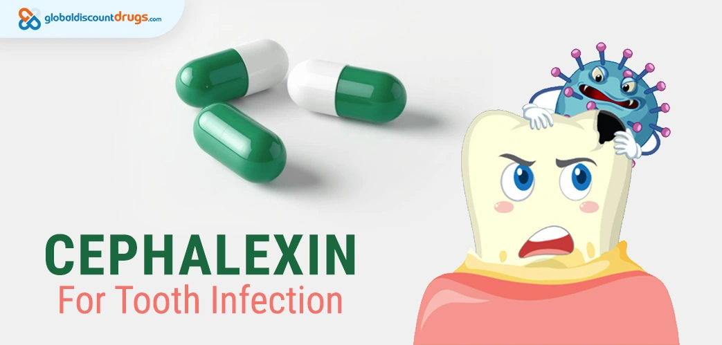 Cephalexin For Tooth Infection