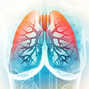 Chronic Obstructive Pulmonary Disease