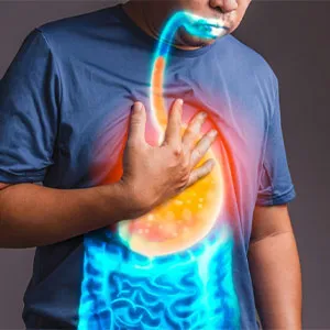 Gastro Esophageal Reflux