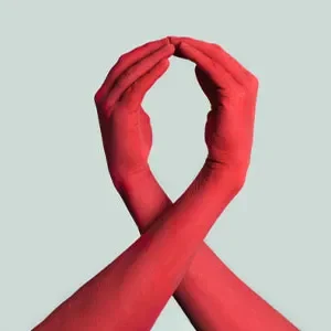 Hiv/Aids