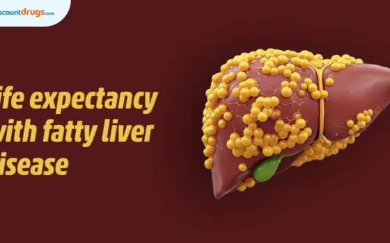 Life expectancy with fatty liver disease