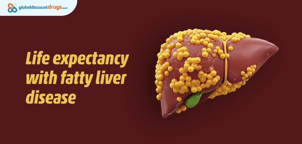 Life expectancy with fatty liver disease