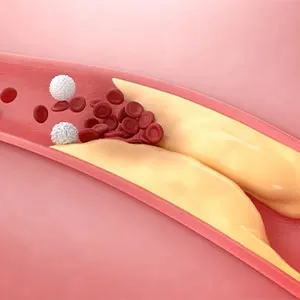 Buy Cholesterol.webp online