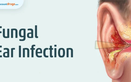 Fungal Ear Infection