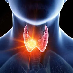 Buy Hypothyroidism.webp online