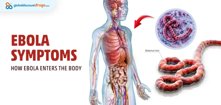 Ebola Symptoms