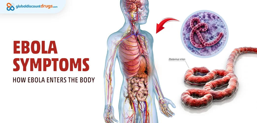 Ebola Symptoms