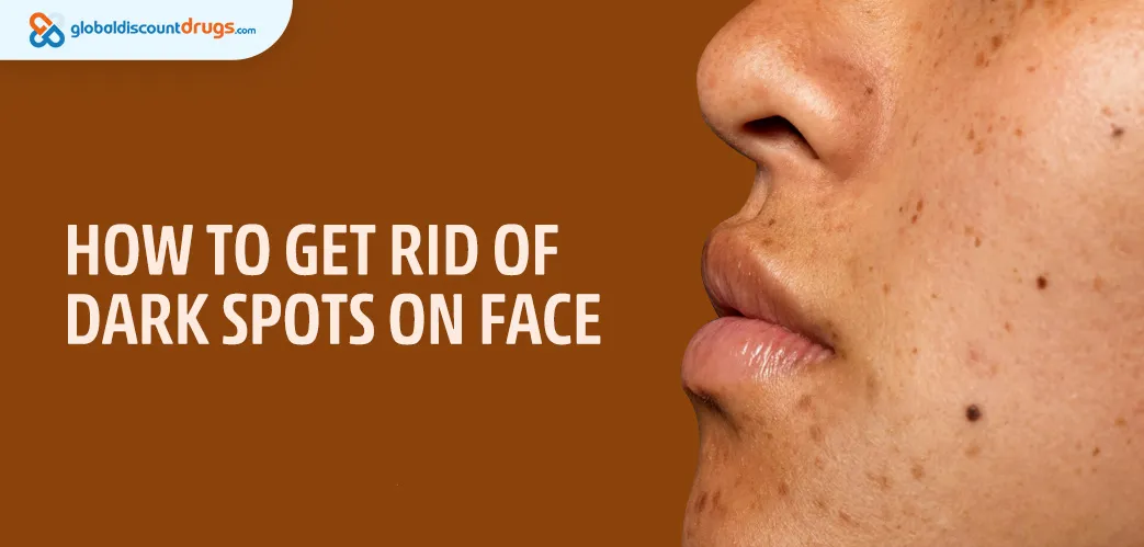 How To Get Rid Of Dark Spots On Face