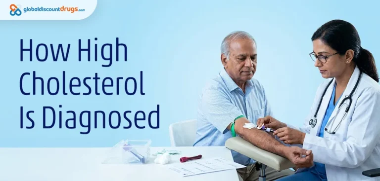 How High Cholesterol Is Diagnosed
