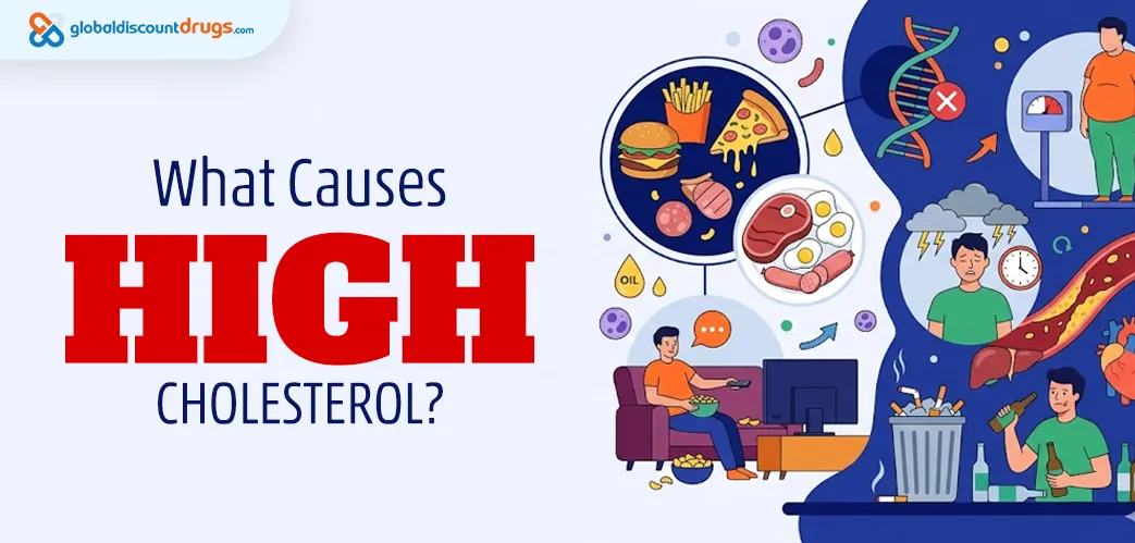 What Causes High Cholesterol?