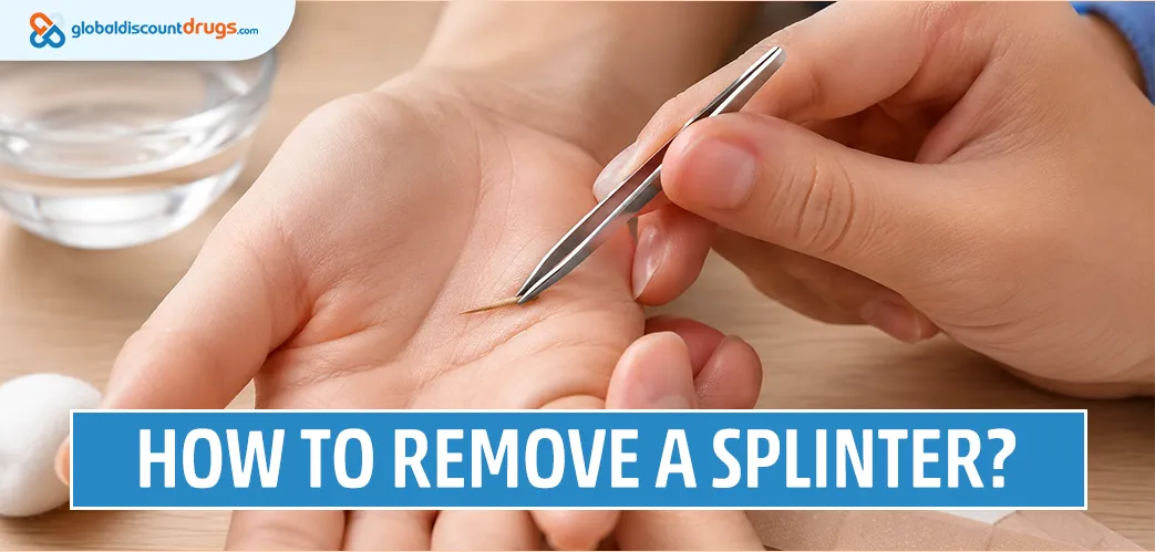How to Remove a Splinter